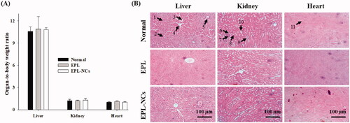 Figure 7. Organ-to-body weight index (A) and histological microphotographs of liver, kidney and heart tissues of mice (B) at day 14 after treatment with EPL-NCs. In histological micrographs, (1) hepatocytes, (2) hepatic artery, (3) sinusoids, (4) central vein, (5) bile duct, (6) bowman capsule, (7) glomerulus, (8) renal tubule, (9) proximal tubule, (10) distal tubule, and (11) myocardial fibers. Organ-to-body weight indices are presented as mean ± S.D. (n = 6).