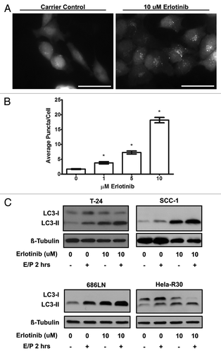 Figure 2. Erlotinib induces autophagosome formation and increased autophagic flux (A) T-24 cells stably expressing GFP-LC3 were treated with carrier control or 1, 5 or 10 μM erlotinib for 24 h, fixed and imaged using epifluorescence microscopy. T-24 cells treated with 10 μM erlotinib (right) were observed to have higher punctate or “dot-like” fluorescence when compared with untreated (left) cells. Representative images of two independent experiments are shown. Bar = 50 μm. (B) Puncta per cell were quantified in cells treated with 0, 1, 5 and 10 μM erlotinib and erlotinib was found to induce a dose dependent increase in GFP-LC3 puncta. Statistically significant dose dependence was observed between all erlotinib doses. Error bars shown are standard error of the mean. *One-way ANOVA P value < 0.0001. (B) T-24, SCC-1, 686LN and HeLa-R30 cells were treated with 10 μM erlotinib for 24 h and lysosomal protease inhibitors E64D and pepstatin A (E/P) were added to medium 2 h before collection of whole cell lysates which were immunoblotted for LC3 and β-tubulin. Increased LC3-II was observed in cells treated with E/P and erlotinib suggesting an increased level of autophagic flux in cells treated with erlotinib. Images shown are representative of three experimental replicates.