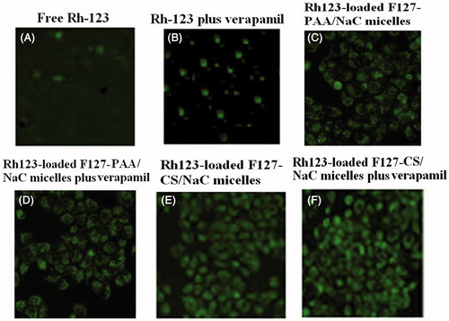 Figure 10. Fluorescence images of MCF-7/Adr cells after incubation for 2 h with Rh-123 solution (A), Rh-123 solution with verapamil (B), Rh-123-loaded F127–PAA/NaC micelles (C), Rh-123-loaded F127–PAA/NaC micelles with verapamil (D), Rh-123-loaded F127–CS/NaC micelles (E), Rh-123-loaded F127–CS/NaC micelles with verapamil (F).