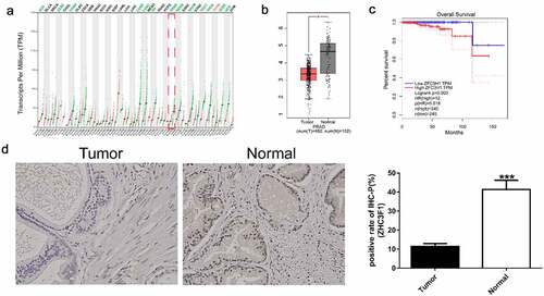 Figure 1. The correlation between ZFC3H1 expression levels and overall survival of patients with PRAD. A, ZFC3H1 expression profile across all tumor samples and paired normal tissues. B, The expression level of ZFC3H1 in PRAD tissues and adjacent non-tumor tissues. C, The overall survival of human PRAD patients in relation with high or low expression levels of ZFC3H1. D. Immunohistochemical staining examined the expression of ZFC3H1 in 10 prostate cancer specimens and paracancerous.