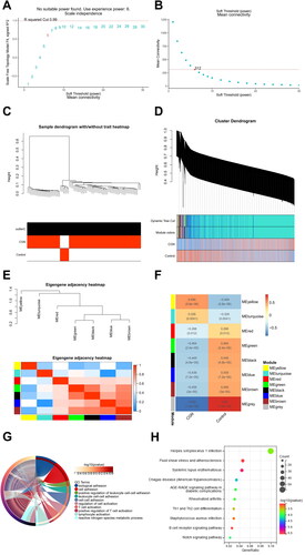 Figure 5. Identification of CGN-associated key modules Based on WGCNA analysis. (A,B) Scale-free fitting index analysis and mean connectivity of soft threshold power from 1 to 30. (C) Clustering dendrogram with tree leaves corresponding to individual samples. (D) Clustering dendrogram of all expressed genes based on a dissimilarity measure (1-TOM). (E) Correlation heatmap of module feature vector. (F) Correlation heatmap between module eigengene and CGN clinical trait. (G) GO biological processes analysis for turquoise module genes. (H) KEGG pathway analysis for turquoise module genes.