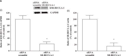 Figure 4. A: Knock-down of hSR-BI/CLA-1 by siRNA. The hSR-BI/CLA-1 protein (i) or mRNA (ii) expression in HEL cells was inhibited by hSR-BI/CLA-1 siRNA treatment but not by a scrambled siRNA. The hSR-BI/CLA-1 protein (i) or mRNA (ii) was detected using Western blot analysis probed with an anti-hSR-BI/CLA-1 antibody or real-time PCR method, respectively. The ratio of hSR-BI/CLA-1/GAPDH (i) or hSR-BI/CLA-1/β-actin (ii) was shown as per cent of control in the figure. Each data point shows the mean and SEM (n = 3) of separate experiments. Abundance of GAPDH served as a control and is shown at the bottom of each lane. The asterisk denotes a significant difference with that in the control HEL cells (cont) (P < 0.05). B: Effect of hSR-BI/CLA-1 knock-down on anti-apoptotic effect of EPO/HDL treatment. siRNA of hSR-BI/CLA-1 (si-hSR-BI/CLA-1) or scrambled siRNA (cont) was transfected into HEL cells, and the induction of apoptosis of HEL cells by etoposide with/without EPO/HDL treatment. The results were expressed as PI positive rate compared to that in the control cells that was arbitrarily set at 100. Each data point shows the mean ± SEM of three separate samples that were performed on separate days (Etopo = HEL cells were treated with 100 μM etoposide; EPO/HDL-24/Etopo = etoposide 100 μM + EPO treatment + HDL treatment; NS = no significant difference). The asterisk denotes a significant difference (P < 0.05). C: HEL cells were incubated with 1 U/mL EPO alone, 500 μg/mL HDL alone, or 500 μg/mL HDL for 20 minafter 1 U/mL EPO treatment for 24 h The quantification of phosphorylated Akt was determined by using ELISA. The results were expressed as relative compared to that in control cells which was arbitrarily set at 100. Each data point shows the mean and SEM of four separate ELISAs that were performed on separate days. The asterisk denotes a significant difference (P < 0.05) (cont = control; EPO = 1 U/mL EPO treatment; HDL = 500 μg/mL HDL treatment; EPO/HDL = 1 U/mL EPO-24 h and 500 μg/mL HDL). D: Effect of EPO and HDL on AP-1 transcriptional activity in HEL cells. HEL cells were transfected with 0.5 μg of pAP1-LUC and treated with 1 U/mL EPO and 500 μg/mL HDL for 24 hbefore cell harvest. All assays were corrected for b-galactosidase activity, and the total amounts of protein per reaction were identical. The results were expressed as relative luciferase activity compared with control cells arbitrarily set at 100. Each data point shows the mean and SEM of three separate transfections that were performed on separate days. The asterisk denotes a significant difference (P < 0.05) (Cont = Control; EPO = 1 U/mL EPO treatment; HDL = 500 μg/mL HDL treatment; EPO/HDL = 1 U/mL EPO and 500 μg/mL HDL for 24 h).