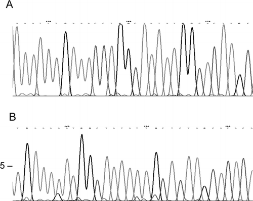 Figure 3 The electropherograms show: A) SENV-H gene from nt 1266 (NCBI accession number AY206683); B) SENV-D gene from nt 1474 (NCBI accession number AB059352).