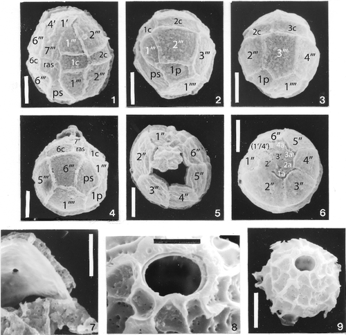 Plate 4. 1–7. Scanning electron photomicrographs of Histiocysta sp. A, from the Lower Eocene (Ypresian) Nanjemoy Formation, Popes Creek, Maryland. Scale bars: figures 1–6 = 10 µm; figure 7 = 5 µm. Figure 1, Left latero-ventral view; figure 2, oblique left lateral view of hypocyst showing relationships of 1‴, 2‴, 3‴, 1p and ps plates; figure 3, oblique dorsal view of hypocyst, centred on third postcingular plate; figure 4, oblique right lateral view of hypocyst; figure 5, apical view showing apical archeopyle and operculum remaining attached along isthmus formed by first and fourth apicals (note anterior intercalaries on operculum); figure 6, apical view with operculum in place; figure 7, close-up of wall showing thicker, smooth autophragm, and ectophragm supported by rod-like elements. 8, 9. Scanning electron photomicrographs of Cladopyxidium sp. B, ENCI Quarry, Maastrichtian, the Netherlands. Scale bar: figure 8 = 5 µm; figure 9 = 10 µm. Specimen in oblique apical view; figure 8 is a detail of the opercular region of figure 9. Note similarities to specimens illustrated in Plate 2, figures 5, 7, 8. Although the specimen appears to have two wall layers (aka the ‘double’ ring around the operculum), only an autophragm is believed to be present.