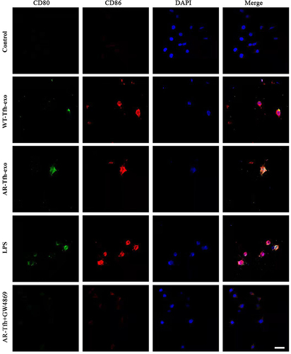 Figure 4 Expression of CD80 and CD86 on DC cells under five different conditions. Sections of DCs were stained Immunofluorescence dyes for CD80 (green) and CD86 (red). DAPI was used to stain nuclei (blue). Representative images are shown from at least three independent experiments. Scale bar at the bottom right stands for 50 μm.