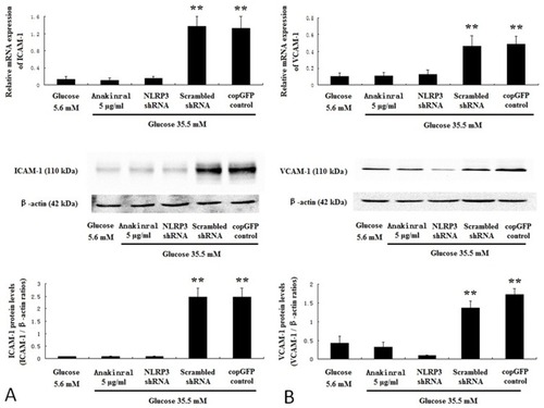 Figure 7 NLRP3 knockdown or IL-1β receptor antagonist suppressed adhesion molecules expression induced by high glucose in HUVECs. HUVECs were infected with NLRP3 shRNA, scrambled shRNA or copGFP control lentiviral particles, and incubated for 7 days with 35.5 mM glucose or 35.5 mM glucose with 5 μg/mL anakinra. HUVECs incubated for 7 days with 5.6 mM glucose served as control. The mRNA and protein expressions of ICAM-1 (A) and VCAM-1 (B) were determined by real-time PCR and Western blotting. Data are mean ± SD (n=5). **P<0.01 vs scrambled shRNA or copGFP control.