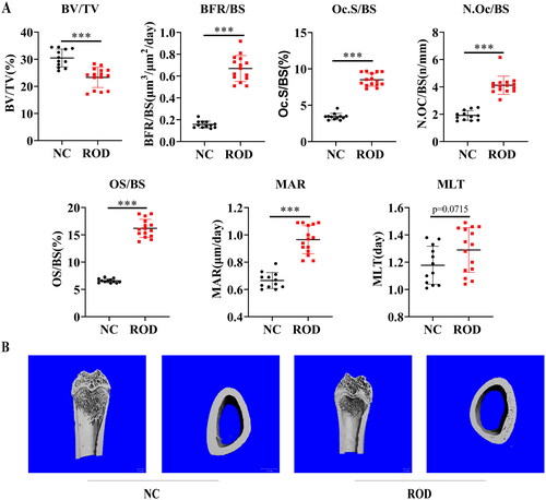 Figure 1. Increased osteoclasts and bone loss in adenine-induced ROD model. (A) Bone histomorphometry data. BV/TV, bone volume/tissue volume; BFR/BS, bone formation rate; Oc.S/BS, osteoclast surface per millimeter bone perimeter; N.Oc/BS, osteoclast number per millimeter bone perimeter; OS/BS, osteoid surface/bone surface; MAR, mineral apposition rate; MLT, mineralization lag time. n = 12-15 per group, ***p < 0.001 or as indicated, student’s t-test. (B) Representative micro-computed tomography images of distal femurs of NC and ROD rats.