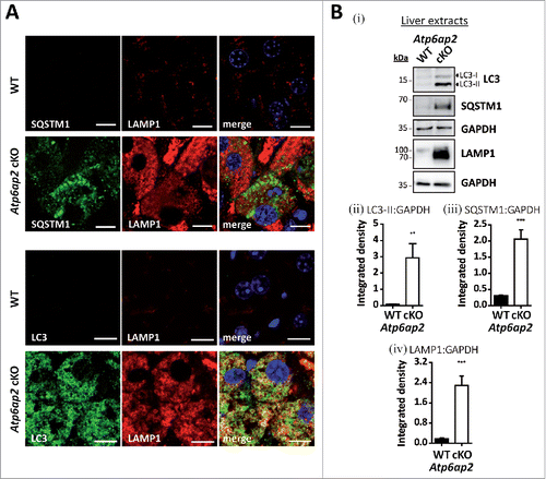 Figure 2. Accumulation of autophagic vacuoles and lysosomes in Atp6ap2 conditional knockout liver. (A) Immunofluorescence analyses of liver sections show an increase in LC3-, SQSTM1- and LAMP1-positive vesicles in ATP6AP2-depleted hepatocytes (cKO) in comparison to control tissue (WT). Scale bars: 10 µm. (Bi) Immunoblot analysis of autophagic marker proteins LC3-I, LC3-II and SQSTM1 and of lysosomal LAMP1 in liver lysates (15 μg per lane) from Atp6ap2 cKO and wild-type mice. All protein concentrations were increased in the knockout samples. (Bii-iv) Quantification of the immunoblots was carried out in relation to GAPDH levels. Shown are mean values ± standard errors from 6 to 7 independent animal preparations per genotype. **P < 0.01, ***P < 0.001 according to unpaired, 2-tailed Student t test.