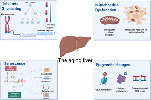Figure 1 Mechanisms of NAFLD and the aging liver. Created with BioRender.com