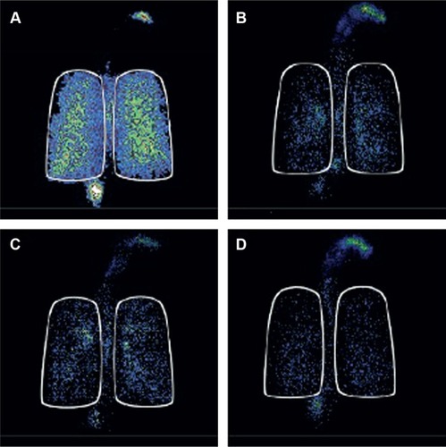 Figure 3 Typical scintigraphic images for Respimat®, Turbuhaler® DPI at slow and fast inhaled flow rates, and pMDI.