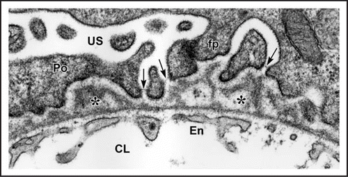 Figure 4 In maturing stage glomeruli, a well developed, thin and extensively fenestrated endothelium (En) is evident. Double basement membranes are generally absent, but several examples of subepithelial projections of basement membrane can be seen (*). In the podocyte layer (Po) foot process (fp) interdigitation is well underway, and the filtration slits are spanned by slit diaphragms (arrows). CL: capillary lumen; US: urinary space. Reproduced with permission (ref. Citation38).