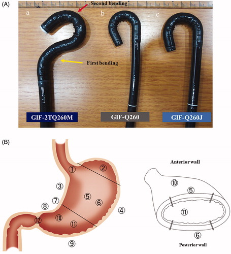 Figure 1. (a) Endoscope structure comparison. GIF Q260J: Scope most commonly used in endoscopic submucosal dissection. It has a water-jet function, is light in weight, and has excellent maneuverability. Outside tip diameter is 9.9 mm and weight is 1.3 kg. GIF Q260: Most flexible model because of the thin diameter, permitting reverse maneuvers; does not have a water-jet function. Outside tip diameter is 9.2 mm and weight is 1.2 kg. GIF 2TQ260M: Multibending scope with two bends (yellow arrow shows first bending point, red arrow shows second bending point). The two bends enable a better approach to the lesion and allow dissection to be performed in a horizontal manner; it has a water-jet function and two-channel forceps. Outside tip diameter is 9.2 mm and weight is 1.5 kg. (b) Treatment area classification of gastric lesion location: Coronal section of stomach showing the 12 lesion locations defined as follows: 1) across the esophagogastric junction, 2) the fornix, 3) lesser curvature of the body, 4) greater curvature of the body, 5) anterior wall of the body, 6) posterior wall of the body, 7) across the angle area, 8) lesser curvature of the antrum, 9) greater curvature of the antrum, 10) anterior wall of the antrum, 11) posterior wall of the antrum, and 12) across the pyloric ring. Inset: Horizontal cross-section through stomach.