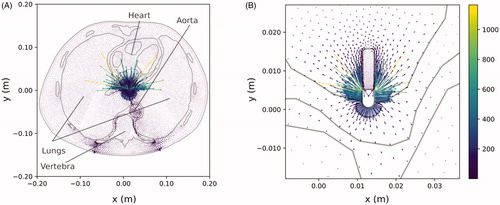 Figure 7. (A) Current density distribution (in A/m) across the thorax computed by the 2D model. (B) Detail around the active electrode.