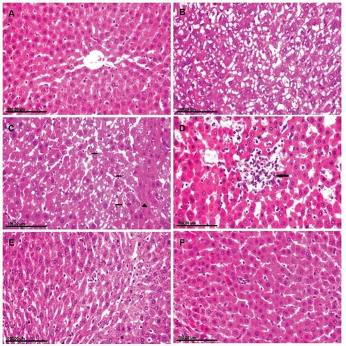 Figure 3 Photomicrograph of liver tissue sections stained with (H&E) of (A) normal rat showing normal hepatocytes. (B–D): CuO-NPs intoxicated rats showing. (B) Diffuse vacuolization of hepatocellular cytoplasm. (C) Cytoplasmic vacuolization (arrow) in some hepatocellular cells and sporadic necrosis (arrowhead) and abundant apoptosis in others as well as the presence of intracytoplasmic eosinophilic globular inclusions. (D) Focal area of coagulative necrosis infiltrated with mononuclear inflammatory cells (arrow). (E) CuO-NPs + 1 mL/kg bwt PJ group showing mild cytoplasmic vacuolization with few apoptotic bodies. (F) CuO-NPs + 3 mL/kg bwt PJ group showing normal hepatocytes with sparse apoptotic figures.