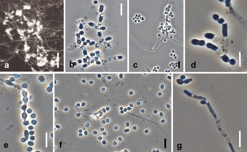 Fig. 9. Spiromastix frutex. Ex-type cultures on MEA. A. Aerial conidiophores. B, C. Conidiophores and conidia. D–G. Terminal and single lateral conidia and arthroconidia. Bars: A = 500 μm, B–G = 5 μm.