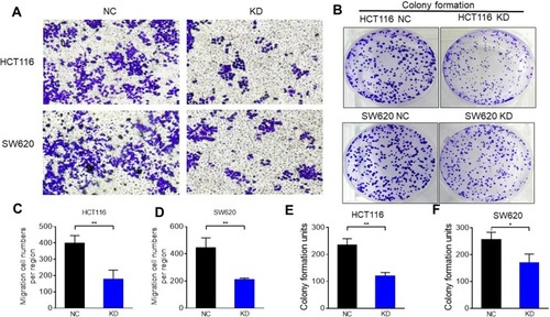 Figure 4 Effects of ENO1 knockdown on the migration and colony-forming capacity of CRC cells. (A) Representative images of Transwell assay showing the migration ability of SW620 and HCT116 cells transfected with control shRNA (NC) or shENO1 (KD) (magnification ×200). (C, D) Migration rate in terms of the relative number of migratory cells; data are represent as the mean ± S.E.M. (n = 5). (B) Representative images showing colonies formed by SW620 and HCT116 cells transfected with control shRNA (NC) or shENO1 (KD); (E, F) Number of colonies in the different groups. Data are presented as the mean ± S.E.M. (n = 3). *P < 0.05, **P < 0.01.