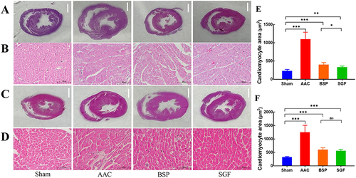 Figure 3 HE staining of cardiac tissue. (A) is the rat heart section after 8 weeks of gavage, (B) is the corresponding enlarged images, (C) is the section after 24 weeks of gavage, and (D) the corresponding enlarged images. (E) is cardiomyocyte cross sectional area after 8 weeks of gavage. (F) is cardiomyocyte cross sectional area after 24 weeks of gavage. The white ruler in (A) and (C) is 2mm, and the black ruler in (B) and (D) is 100 μm. ns p > 0.05; * p < 0.05, ** p < 0.01; *** p < 0.001. Data are presented as mean ± standard deviation (n = 5 for HE staining, n = 25 for myocyte cross sectional area).