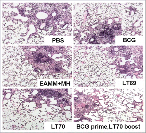Figure 5. Pathologic reaction induced by vaccine immunization and M. tuberculosis challenge. Mice were immunized with BCG, EAMM+MH, LT69, LT70 and BCG prime, LT70 boost respectively. After the last vaccination, mice were aerosol-infected with M. tuberculosis H37Rv 50–100 CFU. The representative histological sections of the lungs from mice and the area ratio of granuloma in sections with HE of all groups were shown. n=5.