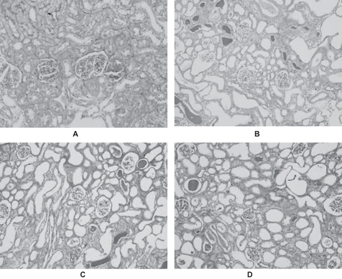 Figure 3. PAS-stained sections of rat kidneys on day 8. The sections from normal rats displayed an integrated renal tubular basement membrane and distinct structure of the renal tubular epithelial cells (A). The characteristic features of nephrotoxic ARF were evident in the cortexes of GM+saline rats (B) and GM+vehicle rats (C). There were no significant differences in histological changes between the GM+saline and GM+vehicle rats. However, treatment with rrALR decreased the amount of tubular lesions significantly (D) (PAS, ×200).