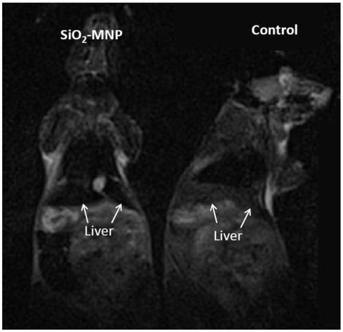 Figure 6 In vivo T2-weighted magnetic resonance images of silica-coated magnetic nanoparticles (SiO2-MNP) in mice 2 hours after injection of phosphate-buffered saline (PBS) (control) or SiO2-MNP in PBS.