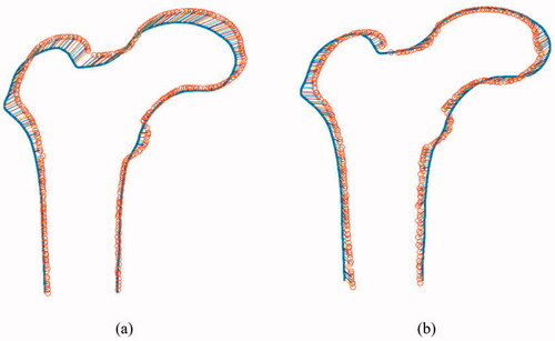 Figure 3. Matching between the 2 D boundary points and projected points of the 3 D model vertices before optimization (a) and after optimization (b). A pair of matched points are linked by a line. After optimization, the red dots are rearranged, which results in lower cost, as shown clearly in (b).