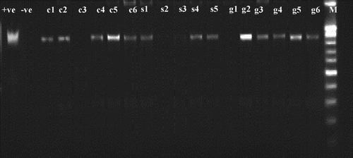 Figure 3. Gel electrophoresis of nested PCR of primers fU5/rU3. Positive nPCR product of 880 bp is shown. +ve: positive control, −ve: healthy control, c1 to c6: randomly selected samples collected from city farms, s1 to s5: randomly selected samples collected from suburb farms, g 1 to g6: randomly selected samples collected from governorate farms, M: 1Kb DNA marker (Invitrogen™, USA)