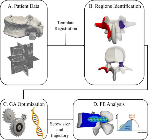 Figure 1. Pipeline of the optimization process: The patient data (A) are combined with a template model to identify insertion points and pedicle regions (B) which are used as input for the GA optimization (C). The optimized screw size and trajectory are used to create an FE model to compare standard and optimized screw (D).