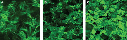 Figure 5. Immunofluorecence confocal analysis of SJL/J astrocytes stained with antibodies to the astrocyte-specific marker GFAP (A) or with antibodies anti-VCAM-1 (B and C). Astrocytes in A and B were sham-infected and those in C were TMEV-infected (m.o.i. of 10). A was taken at ×63 magnification and B and C at ×20 magnification to show a broad field.