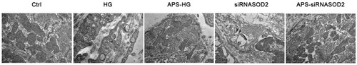 Figure 1 APS protected H9C2 cells ultrastructure. Ultrastructure of cultured cells was observed by a transmission electron microscope (×23,300 magnification). H9C2 cells cultured in the high or normal concentration of glucose were transfected with siRNASOD2 or disrupted siRNA and were further cultured in the presence of APS or normal saline. Disrupted sarcomeres, tubes and mitochondrial cristae were found in the HG group and the siRNASOD2 group, while TEM characteristics of the APS-treated H9C2 cells showed that sarcomas, tubule and mitochondrial crest were almost the same as those in the normal control group. APS, Astragalus polysaccharides; Ctrl, normal control group; HG, high glucose-induced group; APS-HG, APS-treated high glucose-induced group; siRNASOD2, SOD2 interference group; APS-siRNASOD2, APS-treated SOD2 interference group.