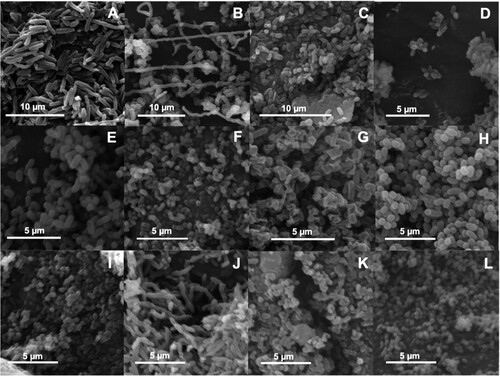 Figure 1. Scanning electron micrographs showing cell morphology of the twelve bacterial isolates obtained from HRAOP MaB-flocs. ECCN 1b (A); ECCN 2b (B); ECCN 3b (C); ECCN 4b (D); ECCN 5b (E); ECCN 6b (F); ECCN 7b (G); ECCN 8b (H); ECCN 9b (I); ECCN 10b (J); ECCN 11b (K) and ECCN 12b (L).