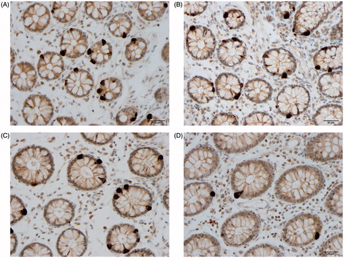 Figure 3. Neurog 3 cells in the colon of a Thai control (A), in a Thai IBS patient (B), in a Norwegian control (C), and in Norwegian IBS patient (D).