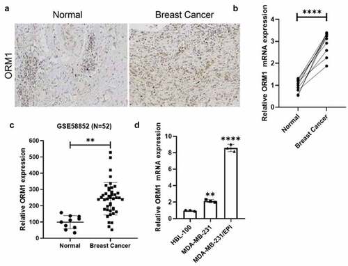 Figure 1. The expression of ORM1 is upregulated in breast cancer a IHC staining of the tissues derived from the patients. b The expression level of ORM1 mRNA in the breast cancer patients’ tissues and the adjacent normal tissues. Data are presented as mean ± SEM from three independent experiments, n = 10, respectively. **** P < 0.0001. c The expression of ORM1 was reanalyzed from the previously published dataset GSE58812. d The expression level of ORM1 mRNA in the normal breast cell line HBL-100 and the breast cancer cell lines. Data are presented as mean ± SEM from three independent experiments. ** P < 0.01; **** P < 0.0001, compared with the HBL-100 cell line