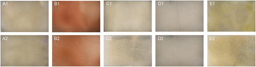 Figure 4 Color changes of dentin surface before (A1–E1) and after (A2–E2) remineralization caused by four polyphenols primers. (A1 and A2) No pretreatment; (B1 and B2) Pretreatment with PA/ethanol solution; (C1 and C2) Pretreatment with myricetin/ethanol solution; (D1 and D2) Pretreatment with resveratrol/ethanol solution; (E1 and E2) Pretreatment with kaempferol/ethanol solution.