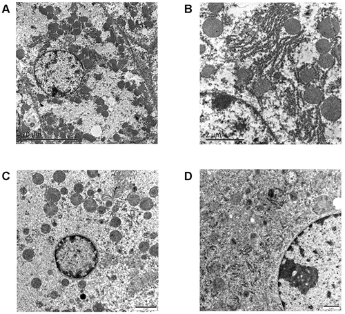 Figure 8 Sodium cyclamate induced liver injury by intraperitoneal injection of 6000 mg/kg/day for 5 days successfully. It was evidenced by transmission electron microscopy micrographs of the hepatocytes of the liver tissue in the control (A and B) and sodium cyclamate-treated at 120h (C and D) groups. (scale bars: (A) 10 μm; B, (C) 2 μm; (D) 1μm).