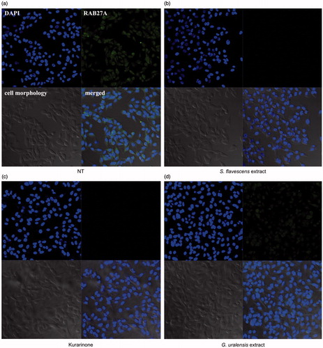 Figure 2. Effects of S. flavescens extract on RAB27A expression in melanoma cell lines. S. flavescens extract and kurarinone regulate expression of RAB27A. SK-MEL-2 melanoma cell lines were transfected with pCNS-RAB27A for 24 h. After transfection, cells were treated with S. flavescens extract, G. uralensis extract and kurarinone for 6 h. (a) The 0.1% DMSO control shows normal distribution of RAB27A. However, levels of RAB27A were reduced by the S. flavescens extract and kurarinone (b, c), whereas higher levels of RAB27A were observed in the cells treated with G. uralensis extract (d).