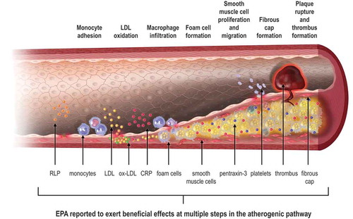 Figure 1. Atherosclerosis is a multistep process ranging from endothelial dysfunction to plaque development, progression, and rupture, leading to thrombus formation and cardiovascular events. EPA has been reported to have beneficial effects on many of these steps. CRP, C-reactive protein; EPA, eicosapentaenoic acid; LDL, low-density lipoprotein; ox-LDL, oxidized low-density lipoprotein; RLP, remnant-like particle. Adapted from [Citation3] with permission from Elsevier.