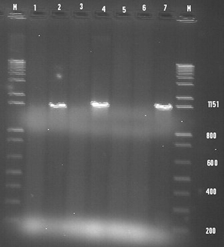 Figure 2 Conventional PCR products of hylA gene with an amplicon size of 1151 bp run on the gel electrophoresis for E.coli O157:H7 isolates.