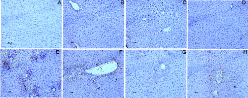 Figure 5. Immunostaining of CD68 in the liver section. (A) blank control group; (B) 25 mg/kg silymarin treatment group; (C) 100 mg/kg DHP1A treatment group; (D) 200 mg/kg DHP1A treatment group; (E) CCl4 treatment group; (F) 25 mg/kg silymarin + CCl4 treatment group; (G) 100 mg/kg DHP1A + CCl4 treatment group and (H) 200 mg/kg DHP1A + CCl4 treatment group.