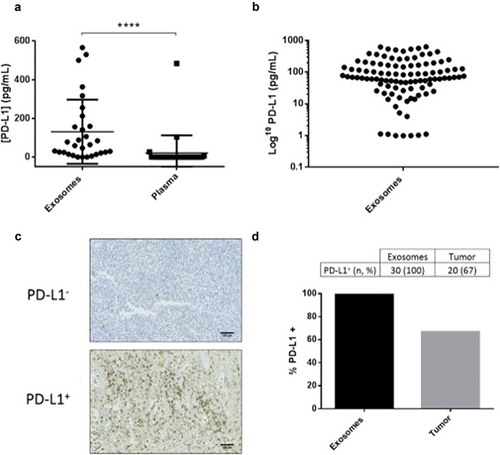 Figure 2. PD-L1 is easily detected in exosomes, when compared with soluble PD-L1 in plasma or in tumour biopsies. (a) Levels of PD-L1 in exosomes isolated from the plasma of melanoma patients compared with PD-L1 levels free in the plasma (n = 30) (****p < 0.0001), determined by ELISA. (b) Levels of ExoPD-L1 isolated from the 100 patient plasma samples of the EXOMEL cohort. (c) Representative IHC image of PD-L1 negative (PD-L1−) or positive (PD-L1+) tumours (22C3 antibody). Scale bars indicated 100 µm. (d) Percentage of patients positive for PD-L1 when measured in circulating exosomes versus tumour biopsies.