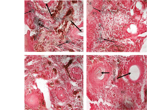 Figure 2.  In vivo transfection of mouse hair follicles after depilation (DP) and/or retinoic acid (RA) treatment and topical application of DMSO mixtures. (a–d) show