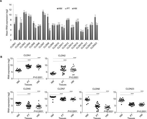 Figure 1 Expression of CLDN genes.Notes: (A) Mean expression of 18 CLDN genes in NM (n=17), PT (n=20), and HM (n=19). The Affymetrix RNA expression data were log2 transformed. (B) Detailed analysis of the RNA expression levels of six CLDN genes in the NM, PT, and HM samples described in (A). Horizontal bars indicate the mean value. ***P<0.001= (Kruskal–Wallis test).Abbreviations: CRC, colorectal cancer; HM, hepatic metastases; NM, normal mucosa; PT, primary CRC tumors.