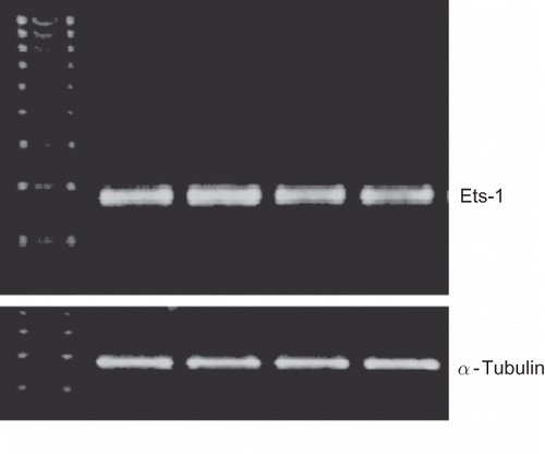 FIGURE 3. Ang II enhances MDCK cell mRNA expression of Ets-1. Equal numbers of MDCK cells were incubated in media containing either buffer, Ang II (10−8 M), losartan (LOS, 10−7 M), Ang II + LOS, for 24 h. Subsequently, cells were harvested, RNA extracted, and probed for Ets-1 by RT-PCR.