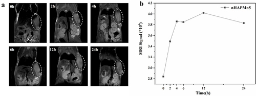 Figure 14 (a) T1-weighted MR coronal images of tumor-bearing mice at different times after intravenous injection of nHAPMn5 and (b) corresponding T1-weighted MRI-signal intensities.
