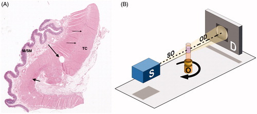 Figure 1. Sample preparation and experimental setup. (A) Colon, normal full thickness. The thin arrows show the intermyenteric connective tissue plate, the short thick arrow points to a myenteric ganglion. The round hole is the sample area (long thick arrow) (hematoxylin and eosin; M/SM: mucosa/submucosa; TC: tenia coli). (B) Schematic of the experimental setup for propagation-based phase-contrast X-ray tomography. The sample object (O), contained in a Kapton® tube, is placed between an X-ray source (S) and a detector (D) and rotates 180° around its axis during the measurement. Details on equipment and parameters can be found in the Supplementary Appendix.