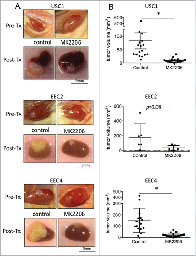 Figure 2. Effect of MK2206 treatment on tumor volume. PDX tumors were grafted under the renal capsule of NSG mice. Mice were treated with either vehicle control or 120mg/kg twice a week with MK2206 for 3 weeks. Tumors were (A) visualized and (B) measured. Tumors from USC1, EEC2 and EEC4 are shown (* denotes statistical significance, p < 0.05).