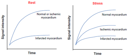 Figure 1 Representation of myocardial perfusion curves during rest and stress conditions.
