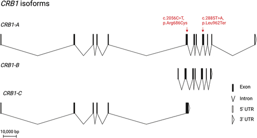 Figure 1. Overview of the three retinal isoforms of CRB1 and its location. All isoforms share exon 6. CRB1-B is the most abundant retinal isoform. It has a unique N-and C-terminus while sharing the transmembrane domain as well as a large part of the extracellular domain with CRB1-A. the patient’s novel nonsense mutation affects CRB1-A and CRB1-B, while the missense mutation affects all retinal CRB1 isoforms. CRB1 is thought to play an important role in maintaining the integrity of the OLM.