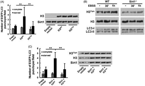 Figure 4. H3T3ph takes part in the Sirt1-caused osteosarcoma cell autophagy. H3−/− Sirt1+/+ MG-63 cells were co-transfected with either H3WT or H3T3A and EGFP-LC3-expressing plasmids. Followed by growth at complete medium or starved medium, (A) the EGFP-LC3 puncta number, along with H3 and Sirt1 levels were detected, (B) the H3T3ph, LC3-I and LC3-II levels were measured. (C) Sirt1 was overexpressed in WT MG-63 cells. Followed by either H3WT or H3T3A and EGFP-LC3-expressing plasmids transfection and grown at different conditions, the EGFP-LC3 puncta number, along with H3T3ph, H3 and Sirt1 levels were measured. N = 3. **p˂.01.