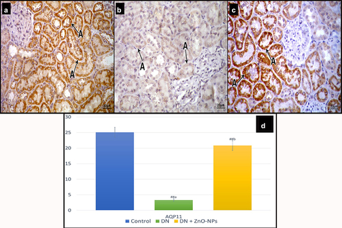 Figure 8. Immune histochemical-stained sections for AQP11 cytoplasmic immune reaction (a). a Control group, most of the tubular cells show intense reaction. b DN group, some tubular cells show faint reaction. c DN + ZnO-NPs group, showing nearly normal reaction in the tubular cells. d the mean area % of positive immunoreactions in anti-aquaporin-11 immune-stained sections. Estimates are displayed as mean ± standard errors (X ± SEM); a: P compared to control group; b: P compared to DN group; #: P< .05; ##: P< .001.