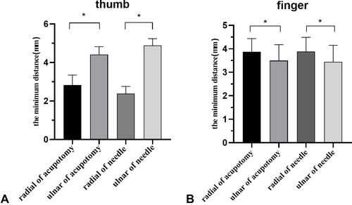 Figure 4 (A) The minimum distance between the incision and the radial and ulnar neurovascular of the thumbs; (B) The minimum distance between the incision and the radial and ulnar neurovascular of the fingers.